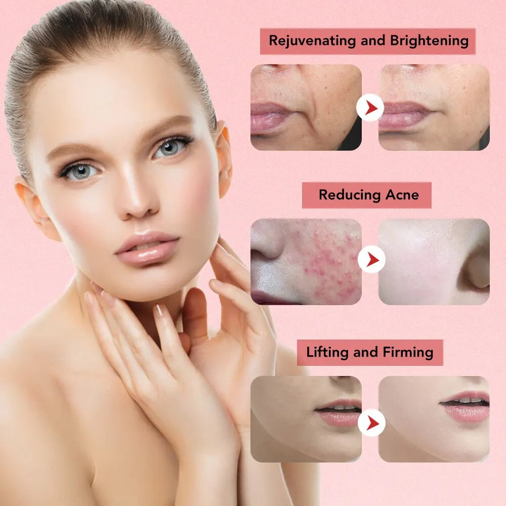 Masajeador Facial Rejuvenecedor